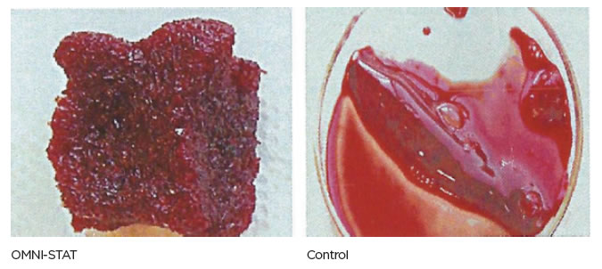 Blood clots after 20 minutes
