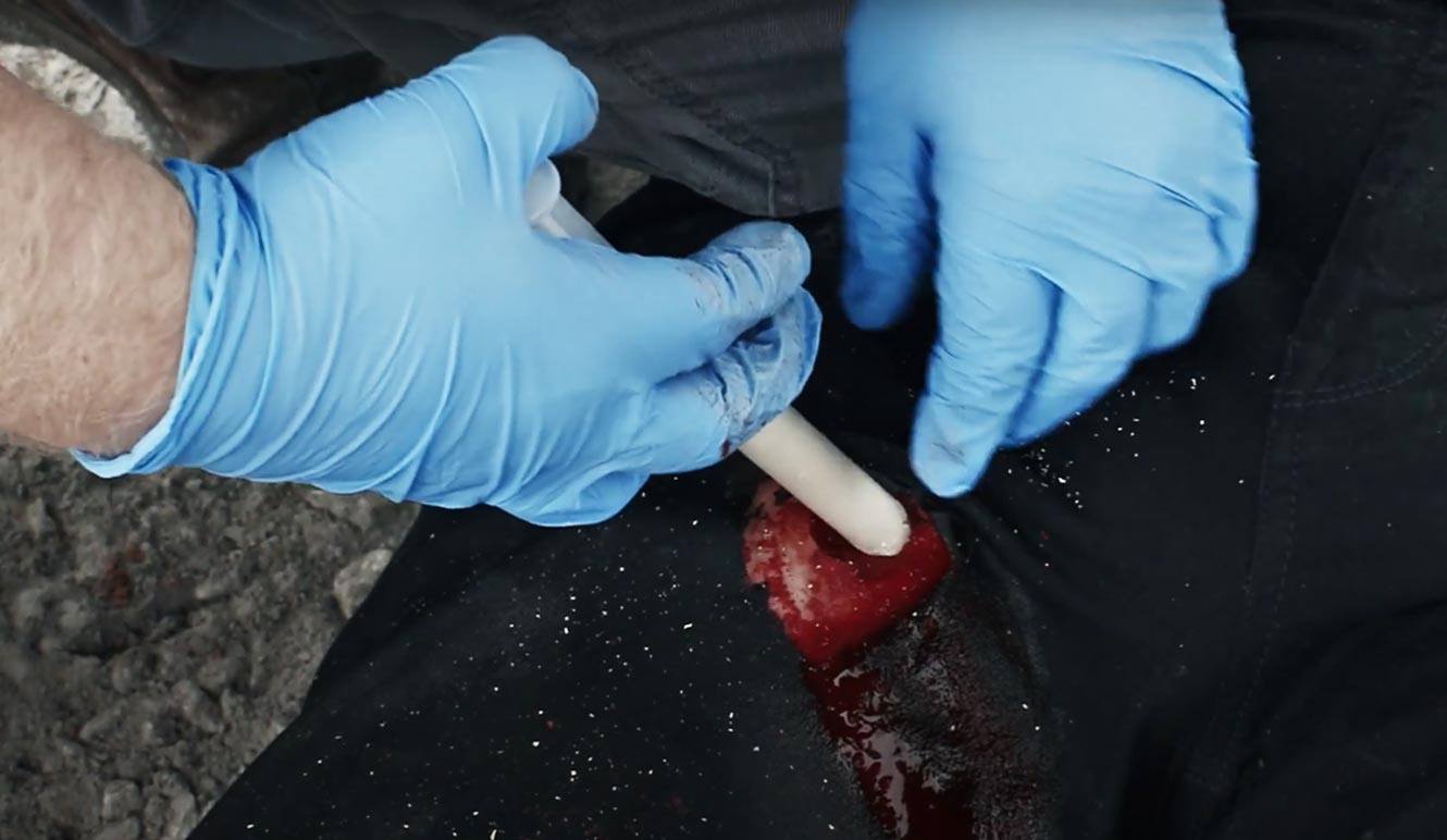 Gunshot & Stab Wound Treatment